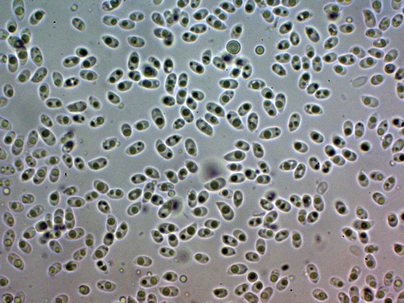 Un hydnoide corticale da identificare